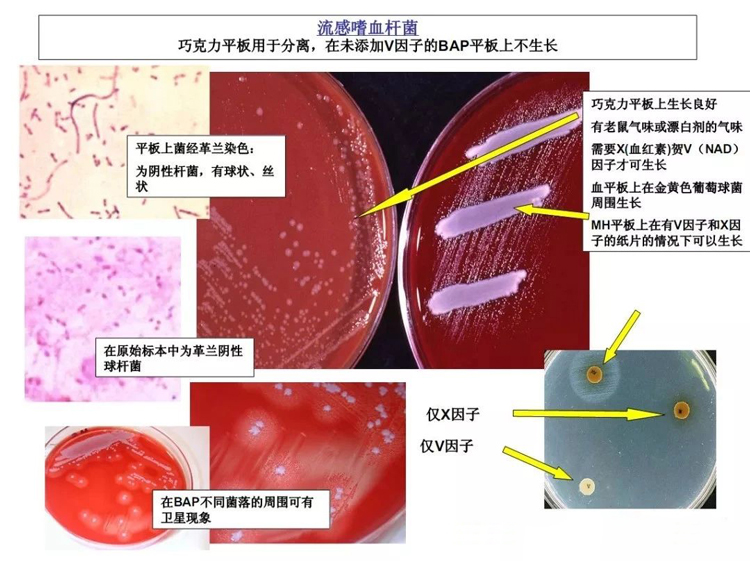 流感嗜血杆菌生化特征