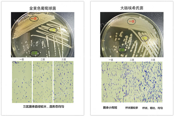 细菌在平板三区的形态特征对比
