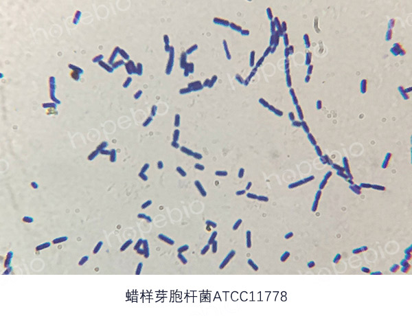 革兰氏染色镜检图——蜡样芽孢杆菌