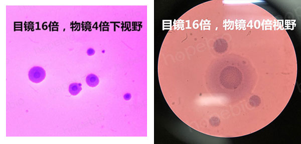 口腔支原体平板法镜检图（结晶紫染色）