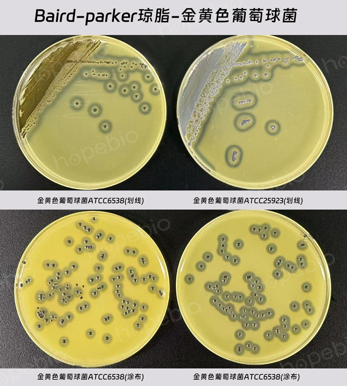 Baird-Parker琼脂-金黄色葡萄球菌(划线及涂布)