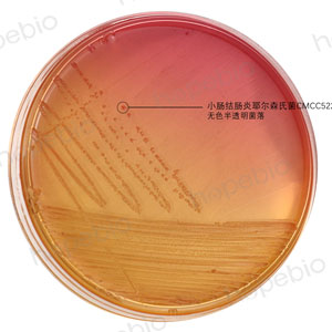 mac-小肠结肠炎耶尔森氏菌/